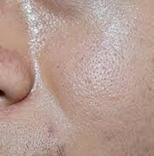 oil skin